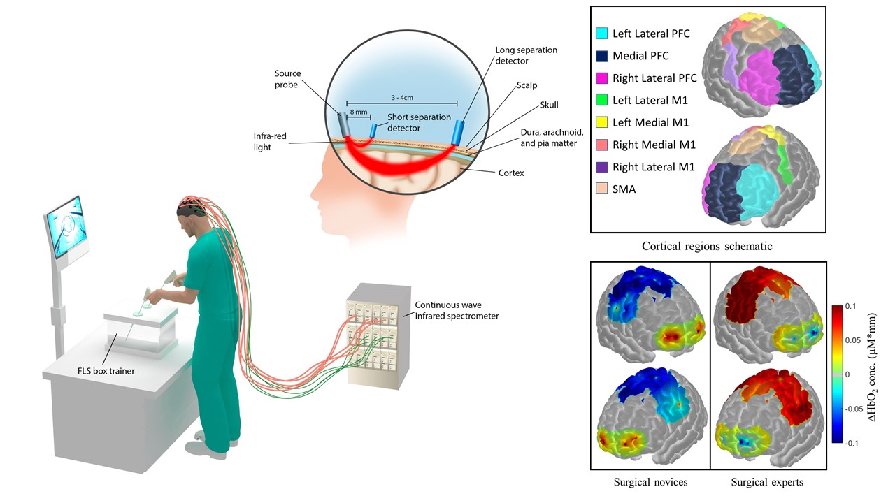 Diagram of non-invasive brain imaging